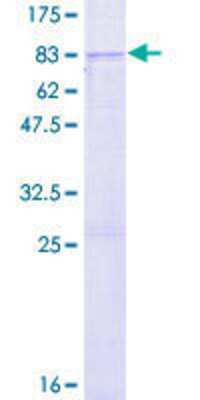 12.5% SDS-PAGE Stained with Coomassie Blue.