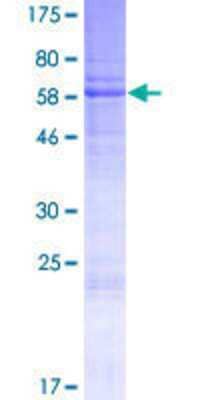 Other Recombinant Human CCSMST1 GST (N-Term) Protein