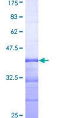 SDS-PAGE Recombinant Human NEK8 GST (N-Term) Protein