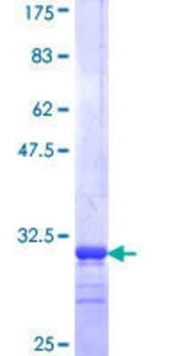 12.5% SDS-PAGE Stained with Coomassie Blue.