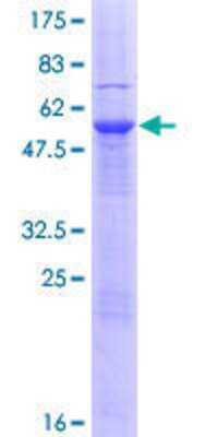 12.5% SDS-PAGE Stained with Coomassie Blue.