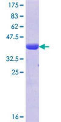 12.5% SDS-PAGE Stained with Coomassie Blue.