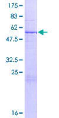 SDS-PAGE Recombinant Human THEM5 GST (N-Term) Protein