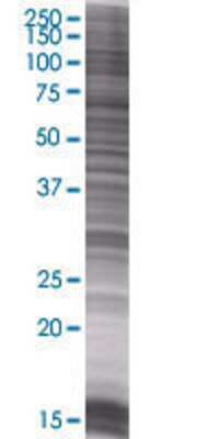 FBXW12 transfected lysate.