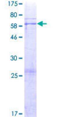 12.5% SDS-PAGE Stained with Coomassie Blue.
