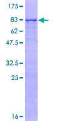 Unknown Recombinant Human RNF180 GST (N-Term) Protein