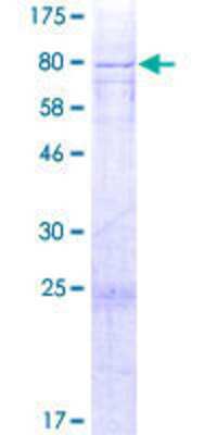 12.5% SDS-PAGE Stained with Coomassie Blue.