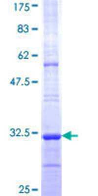 12.5% SDS-PAGE Stained with Coomassie Blue.