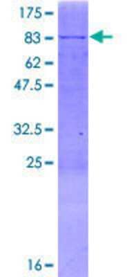 12.5% SDS-PAGE Stained with Coomassie Blue.