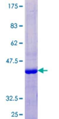 SDS-Page: Recombinant Human KRTAP13-3 Protein [H00337960-P01] - 12.5% SDS-PAGE Stained with Coomassie Blue.