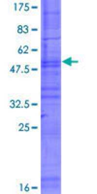12.5% SDS-PAGE Stained with Coomassie Blue.