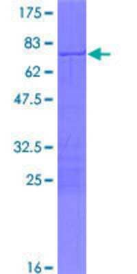 Other Recombinant Human CHX10 GST (N-Term) Protein