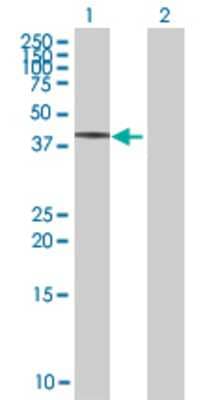 Lane 1: CHX10 transfected lysate (39.82 KDa) Lane 2: Non-transfected lysate.
