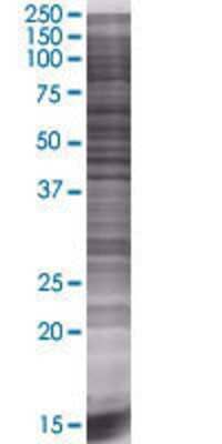 ENPP7 transfected lysate.