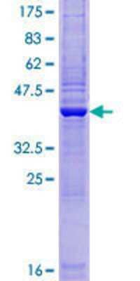 SDS-Page: Recombinant Human ZBTB8OS Protein [H00339487-P01] - 12.5% SDS-PAGE Stained with Coomassie Blue.