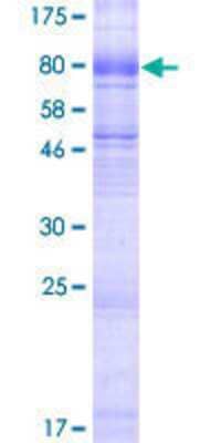 12.5% SDS-PAGE Stained with Coomassie Blue.