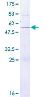 12.5% SDS-PAGE Stained with Coomassie Blue.