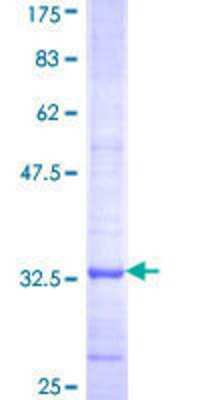 12.5% SDS-PAGE Stained with Coomassie Blue.
