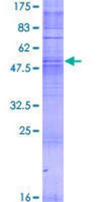 12.5% SDS-PAGE Stained with Coomassie Blue.