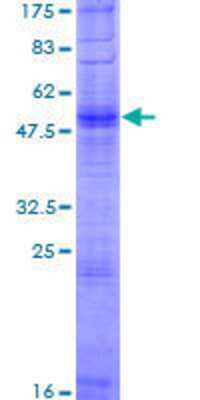 12.5% SDS-PAGE Stained with Coomassie Blue.