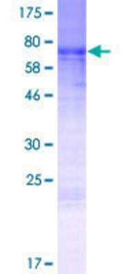 Other Recombinant Human MURC GST (N-Term) Protein
