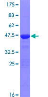 Other Recombinant Human ZNF81 GST (N-Term) Protein
