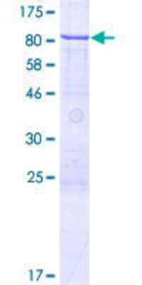 12.5% SDS-PAGE Stained with Coomassie Blue.