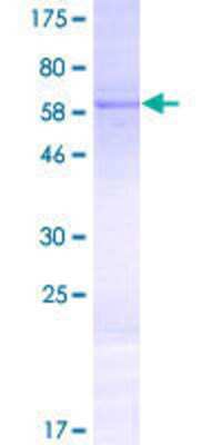 12.5% SDS-PAGE Stained with Coomassie Blue.