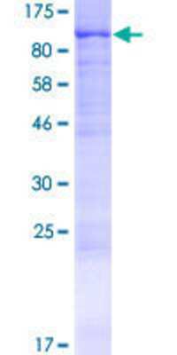12.5% SDS-PAGE Stained with Coomassie Blue.