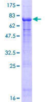 12.5% SDS-PAGE Stained with Coomassie Blue.