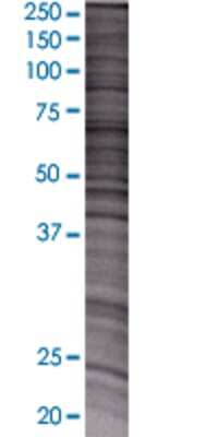 NMNAT3 transfected lysate.