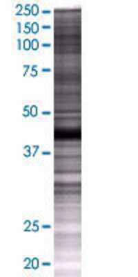 RILPL1 transfected lysate.