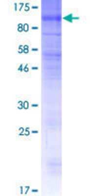 12.5% SDS-PAGE Stained with Coomassie Blue.