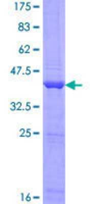 Other Recombinant Human ANKRD37 GST (N-Term) Protein