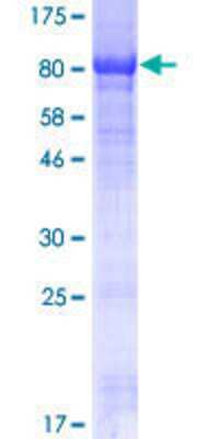 12.5% SDS-PAGE Stained with Coomassie Blue.