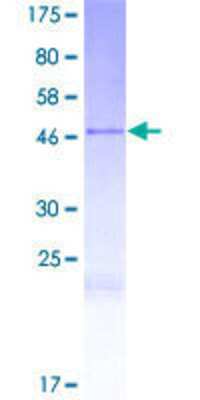 12.5% SDS-PAGE Stained with Coomassie Blue.