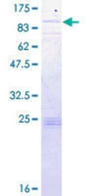 12.5% SDS-PAGE Stained with Coomassie Blue.