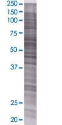 SLC27A1 transfected lysate.