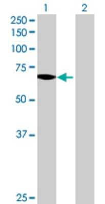 Lane 1: SLC27A1 transfected lysate (71.17 KDa) Lane 2: Non-transfected lysate.