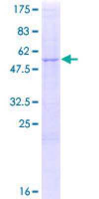 12.5% SDS-PAGE Stained with Coomassie Blue.