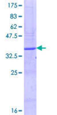 12.5% SDS-PAGE Stained with Coomassie Blue.