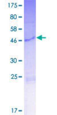 12.5% SDS-PAGE Stained with Coomassie Blue.