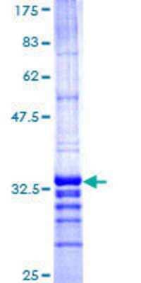 12.5% SDS-PAGE Stained with Coomassie Blue.
