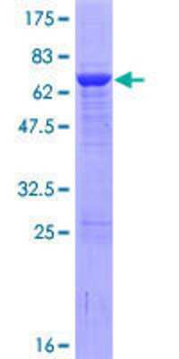 Other Recombinant Human RPSAP58 GST (N-Term) Protein