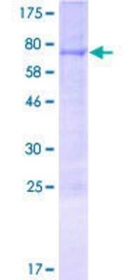 12.5% SDS-PAGE Stained with Coomassie Blue.