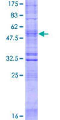 12.5% SDS-PAGE Stained with Coomassie Blue.