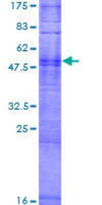 12.5% SDS-PAGE Stained with Coomassie Blue.