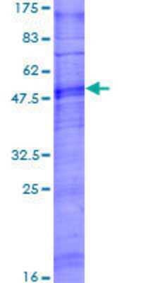 12.5% SDS-PAGE Stained with Coomassie Blue.