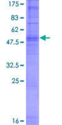 12.5% SDS-PAGE Stained with Coomassie Blue.