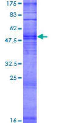 12.5% SDS-PAGE Stained with Coomassie Blue.
